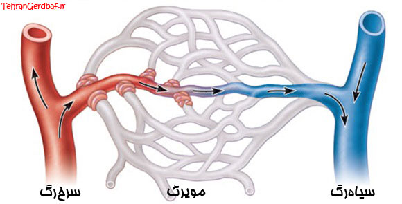 جوراب واریس